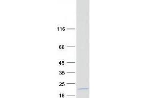Validation with Western Blot (TTC32 Protein (Myc-DYKDDDDK Tag))