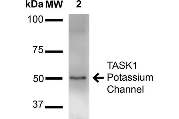 KCNK3 antibody  (AA 251-411)