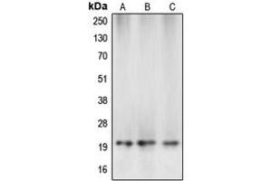 Western blot analysis of Caspase 5 p20 expression in MCF7 (A), mouse kidney (B), rat liver (C) whole cell lysates. (Caspase 5 p20 antibody  (Center))