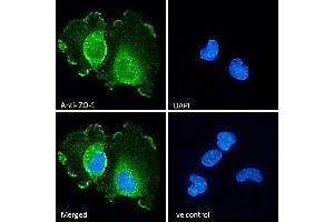 (ABIN570961) Immunofluorescence analysis of paraformaldehyde fixed U251 cells, permeabilized with 0. (TJP1 antibody  (Internal Region))