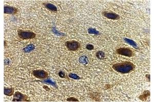 Immunohistochemistry (IHC) image for anti-Adiponectin (ADIPOQ) (C-Term) antibody (ABIN1030223) (ADIPOQ antibody  (C-Term))