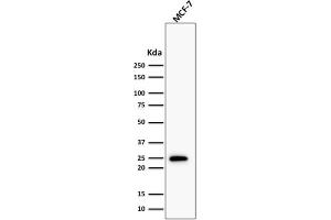Western Blot Analysis of human MCF-7 cell lysate using Bcl-2 Rabbit Recombinant Monoclonal Antibody (BCL2/1878R). (Recombinant Bcl-2 antibody)