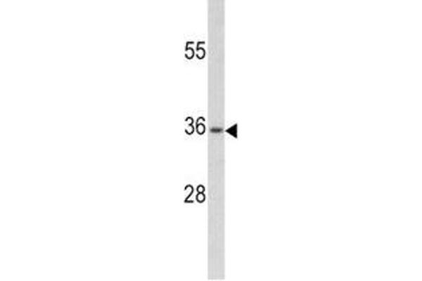 PAX4 antibody  (AA 171-200)