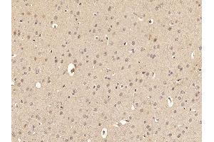 Immunohistochemistry (Paraffin-embedded Sections) (IHC (p)) image for anti-Forkhead Box O3 (FOXO3) (pSer318), (pSer321) antibody (ABIN684688)