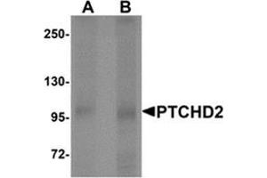 Western blot analysis of PTCHD2 in mouse kidney tissue lysate with PTCHD2 Antibody  at (A) 1 and (B) 2 μg/ml. (PTCHD2 antibody  (Middle Region))