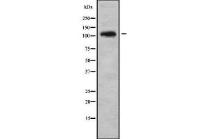 Western blot analysis of ADAMTS1 using K562 whole cell lysates