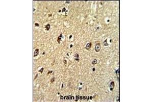 Formalin-fixed and paraffin-embedded human brain tissue with ABCC5 Antibody (Center), which was peroxidase-conjugated to the secondary antibody, followed by DAB staining.