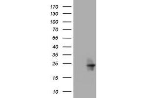 Image no. 1 for anti-Visinin-Like 1 (VSNL1) (AA 2-191) antibody (ABIN1491135) (VSNL1 antibody  (AA 2-191))