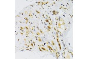 Immunohistochemistry of paraffin-embedded human stomach using RPL13 Antibody (ABIN2559760) at dilution of 1:100 (40x lens). (RPL13 antibody)