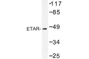 Image no. 1 for anti-Endothelin Receptor Type A (EDNRA) antibody (ABIN317861) (Endothelin-1 Receptor antibody)