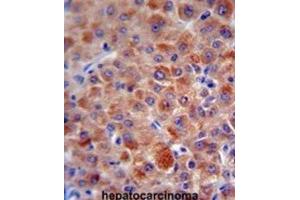 Immunohistochemistry (IHC) image for anti-Complement Factor H (CFH) antibody (ABIN5015561)