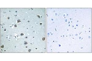 Immunohistochemistry analysis of paraffin-embedded human brain tissue, using GNAL Antibody. (GNAL antibody  (AA 41-90))