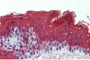 Human Skin: Formalin-Fixed, Paraffin-Embedded (FFPE) (Cytokeratin 1 antibody  (C-Term))
