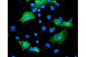 Immunofluorescence (IF) image for anti-ADP-Ribosylation Factor GTPase Activating Protein 1 (ARFGAP1) antibody (ABIN1496684) (ARFGAP1 antibody)