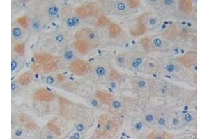Detection of GDI1 in Human Liver Tissue using Polyclonal Antibody to GDP Dissociation Inhibitor 1 (GDI1) (GDI1 antibody  (AA 1-274))
