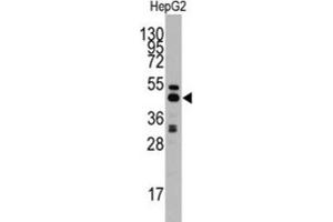 Western Blotting (WB) image for anti-Adenosylhomocysteinase (AHCY) antibody (ABIN3001595) (AHCY antibody)