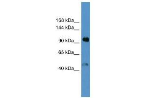 Western Blot showing Lp (a) antibody used at a concentration of 1-2 ug/ml to detect its target protein. (LPA antibody  (Middle Region))