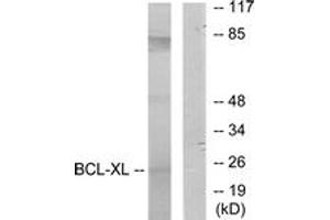 Western blot analysis of extracts from 293 cells, treated with UV, using BCL-XL (Ab-62) Antibody.