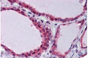 Thyroid, Human: Formalin-Fixed, Paraffin-Embedded (FFPE) (THRSP antibody)
