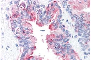 Human Prostate: Formalin-Fixed, Paraffin-Embedded (FFPE) (ADAM20 antibody  (Internal Region))