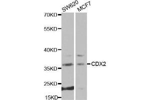 Western blot analysis of extracts of various cell lines, using CDX2 antibody. (CDX2 antibody  (AA 1-180))