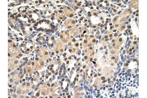 ANP32E antibody was used for immunohistochemistry at a concentration of 4-8 ug/ml to stain EpitheliaI cells of renal tubule (arrows) in Human Kidney. (ANP32E antibody)