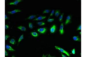Immunofluorescent analysis of Hela cells using ABIN7145930 at dilution of 1:100 and Alexa Fluor 488-congugated AffiniPure Goat Anti-Rabbit IgG(H+L) (CCR4 antibody  (AA 309-360))