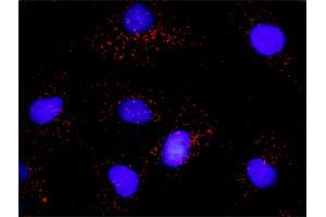 Proximity Ligation Analysis of protein-protein interactions between PTK2 and PLCG1. (FAK antibody  (AA 1-680))