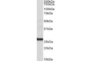 ABIN185660 (1µg/ml) staining of Human Skin lysate (35µg protein in RIPA buffer).