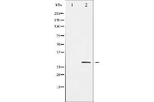 Western blot analysis of SNAI1 phosphorylation expression in HT29 whole cell lysates,The lane on the left is treated with the antigen-specific peptide. (SNAIL antibody  (pSer246))