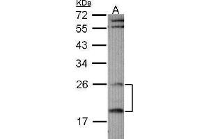 Western Blotting (WB) image for anti-Regulator of G-Protein Signaling 4 (RGS4) antibody (ABIN2856953)