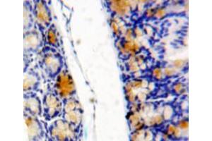 Used in DAB staining on fromalin fixed paraffin-embedded bowels tissue (eIF4EBP1 antibody  (AA 2-117))
