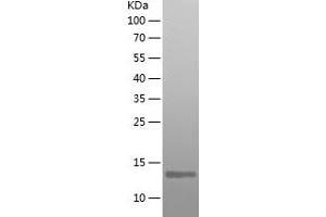 Family with Sequence Similarity 19 (Chemokine (C-C Motif)-Like), Member A5 (FAM19A5) (AA 26-125) protein (His tag)