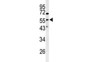 Western blot analysis of Vimentinin antibody and HeLa lysate (Vimentin antibody  (AA 63-90))