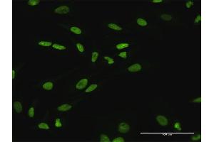 Immunofluorescence of purified MaxPab antibody to SATB1 on HeLa cell. (SATB1 antibody  (AA 1-763))