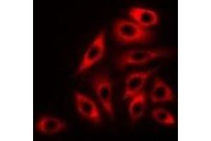 Immunofluorescent analysis of RPLP0 staining in K562 cells. (RPLP0 antibody)