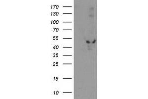 HEK293T cells were transfected with the pCMV6-ENTRY control (Left lane) or pCMV6-ENTRY EIF2B3 (Right lane) cDNA for 48 hrs and lysed. (EIF2B3 antibody)