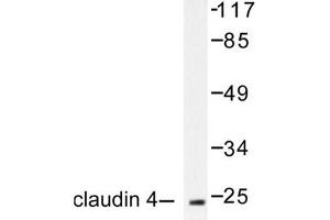 Image no. 2 for anti-Claudin 4 (CLDN4) antibody (ABIN265363) (Claudin 4 antibody)