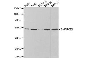 Western Blotting (WB) image for anti-SWI/SNF Related, Matrix Associated, Actin Dependent Regulator of Chromatin, Subfamily E, Member 1 (SMARCE1) antibody (ABIN1876549) (SMARCE1 antibody)