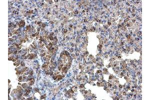 IHC-P Image Monoamine Oxidase B antibody [N2C3] detects Monoamine Oxidase B protein at cytoplasm on mouse lung by immunohistochemical analysis. (Monoamine Oxidase B antibody)