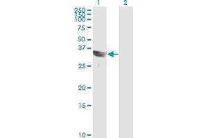 Western Blot analysis of GSC expression in transfected 293T cell line by GSC monoclonal antibody (M01), clone 4H7. (GSC antibody  (AA 151-257))