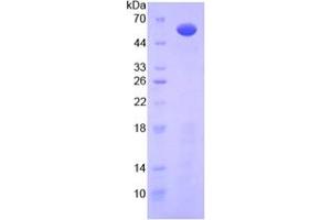 SDS-PAGE analysis of Mouse IL10Ra Protein. (IL-10RA Protein)