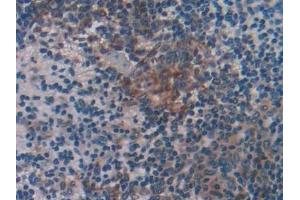 Immunohistochemistry (IHC) image for anti-HLA-DR-gamma (CD74) (AA 64-205) antibody (ABIN7443722)