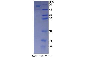 SDS-PAGE analysis of Rat ANKRD1 Protein.