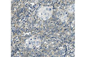 IHC analysis of PHEX using anti-PHEX antibody (ABIN7600072). (PHEX antibody  (AA 145-718))