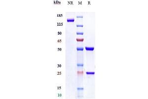 Anti- Human LAG3( Relatlimab) on SDS-PAGE under reducing (R) condition. (Recombinant LAG3 (Relatlimab Biosimilar) antibody)