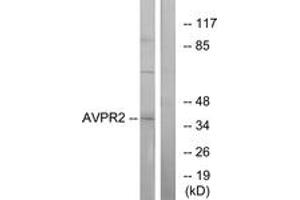 Western Blotting (WB) image for anti-Arginine Vasopressin Receptor 2 (AVPR2) (AA 72-121) antibody (ABIN2891101) (AVPR2 antibody  (AA 72-121))