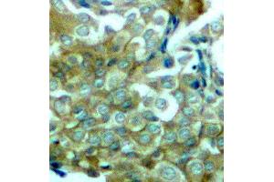 Immunohistochemistry (IHC) image for anti-Epidermal Growth Factor Receptor (EGFR) (pTyr1172) antibody (ABIN1870126) (EGFR antibody  (pTyr1172))