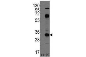 Western Blotting (WB) image for anti-CD8a Molecule (CD8A) (AA 150-180) antibody (ABIN3030431)