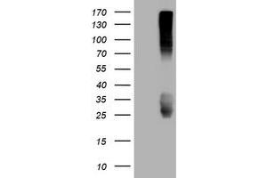 Image no. 3 for anti-CD99 (CD99) antibody (ABIN1497384) (CD99 antibody)